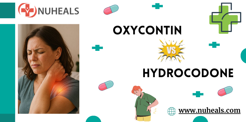 OxyContin Vs Hydrocodone Alt Text