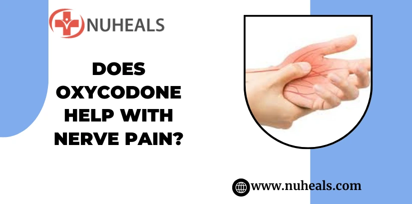 Does Oxycodone Help With Nerve Pain? Alt Text