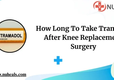 How Long To Take Tramadol After Knee Replacement Surgery Alt Text